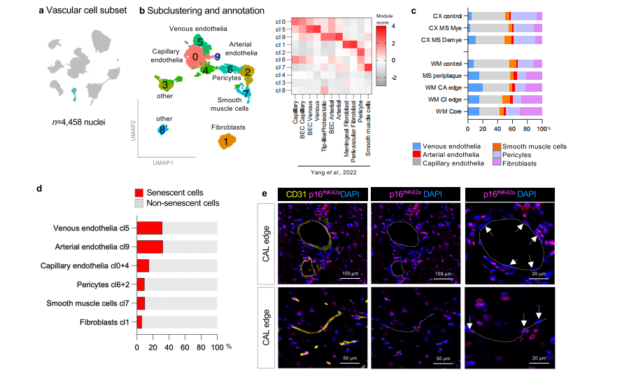 Nature Communications | (2025)类器官与炎症因子诱导类衰老