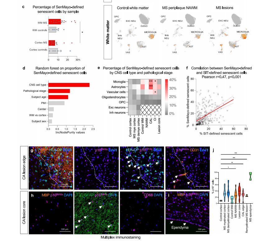 Nature Communications | (2025)类器官与炎症因子诱导类衰老