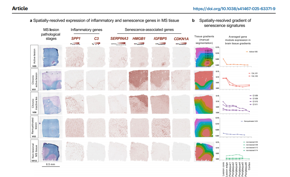 Nature Communications | (2025)类器官与炎症因子诱导类衰老
