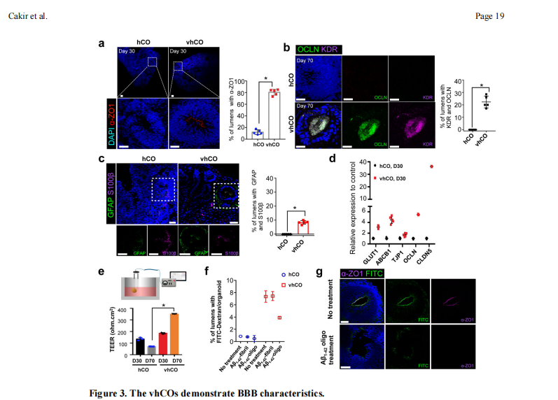 Kirkstall Quasi Vivo血管化腦類器官的構(gòu)建策略