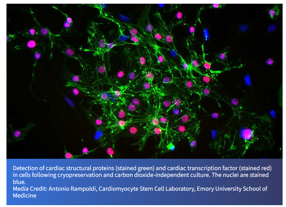 微重力三維細(xì)胞培養(yǎng)系統(tǒng)：開啟心臟再生醫(yī)學(xué)的新紀(jì)元