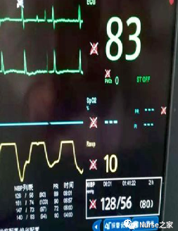 监护仪参数怎么看监护仪各项参数的阈值如何设置？_https://www.jmylbn.com_新闻资讯_第2张