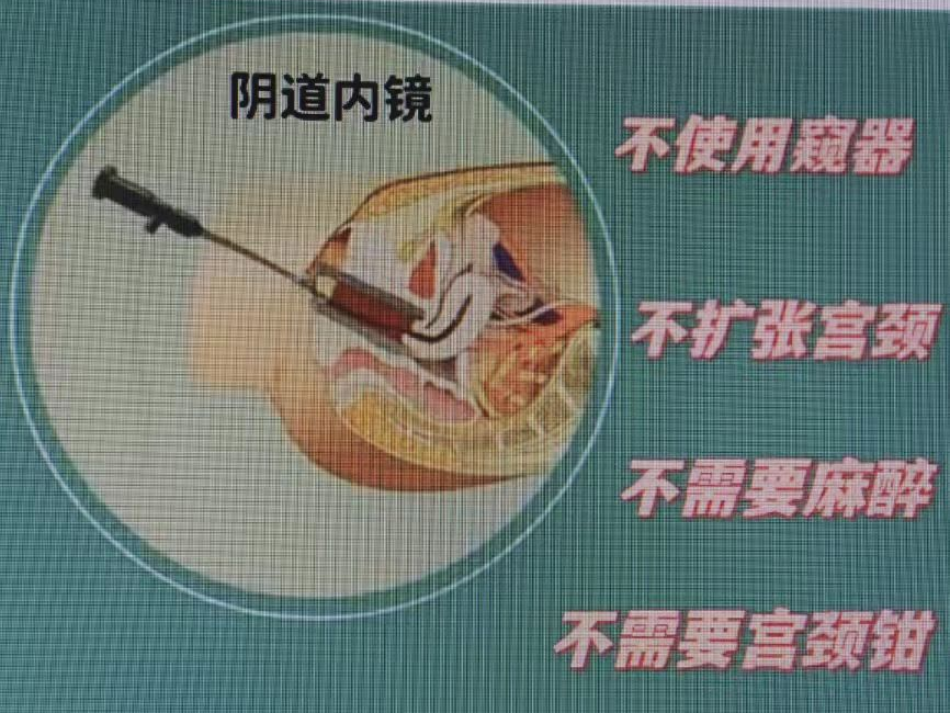 宫内镜怎么进入子宫【健康处方】带您了解“阴道内镜”_https://www.jmylbn.com_新闻资讯_第2张