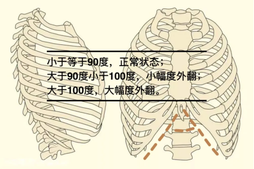 产后胸肋骨疼怎么回事科普丨产后容易被忽略的问题——肋骨外翻_https://www.jmylbn.com_新闻资讯_第14张