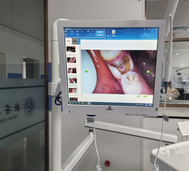 口腔内窥镜线怎么链接看牙新体验 高清 舒适 可视化的口腔内窥镜_https://www.jmylbn.com_新闻资讯_第13张