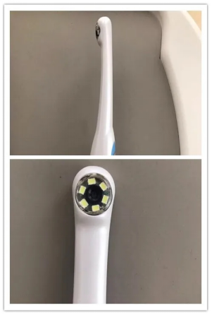 口腔内窥镜线怎么链接看牙新体验 高清 舒适 可视化的口腔内窥镜_https://www.jmylbn.com_新闻资讯_第8张