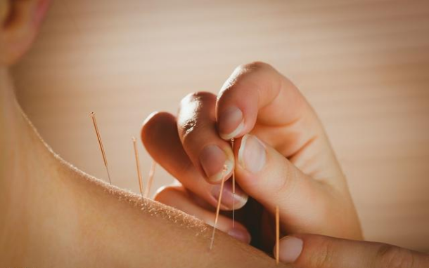 导什么针什么作用“药之不达，唯针可到”中医针灸的功效你知多少？_https://www.jmylbn.com_新闻资讯_第25张