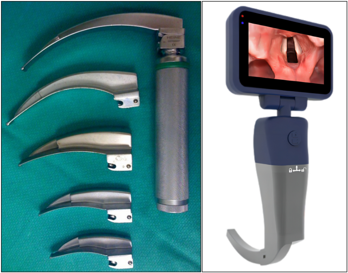 患者怎么选择人工鼻气管插管、气管切开...图解人工气道建立步骤_https://www.jmylbn.com_新闻资讯_第5张