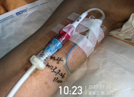 为什么用银敷每天都在换药，这些治疗性敷料你用对了吗？_https://www.jmylbn.com_新闻资讯_第5张