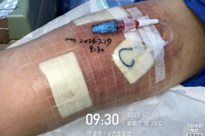 为什么用银敷每天都在换药，这些治疗性敷料你用对了吗？_https://www.jmylbn.com_新闻资讯_第17张