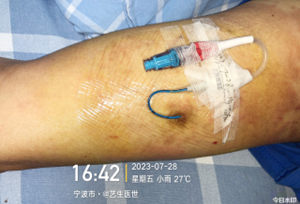 为什么用银敷每天都在换药，这些治疗性敷料你用对了吗？_https://www.jmylbn.com_新闻资讯_第19张