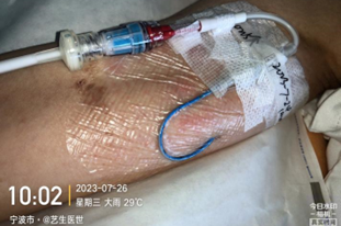 为什么用银敷每天都在换药，这些治疗性敷料你用对了吗？_https://www.jmylbn.com_新闻资讯_第2张