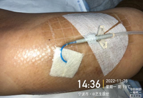 为什么用银敷每天都在换药，这些治疗性敷料你用对了吗？_https://www.jmylbn.com_新闻资讯_第13张