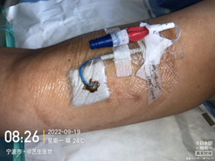 为什么用银敷每天都在换药，这些治疗性敷料你用对了吗？_https://www.jmylbn.com_新闻资讯_第10张