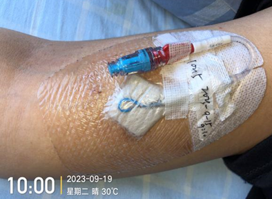 人工敷料怎么照顾伤口外科伤口换药经验，3 个字总结，看完都收藏了_https://www.jmylbn.com_新闻资讯_第7张