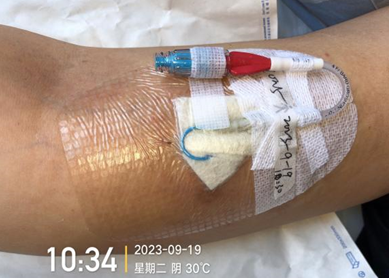 人工敷料怎么照顾伤口外科伤口换药经验，3 个字总结，看完都收藏了_https://www.jmylbn.com_新闻资讯_第10张