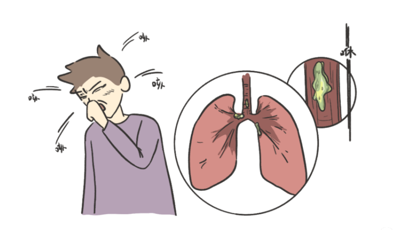 为什么要电动吸痰排痰设备有哪些？为什么推荐使用咳痰机？看完这个就懂了！_https://www.jmylbn.com_新闻资讯_第5张