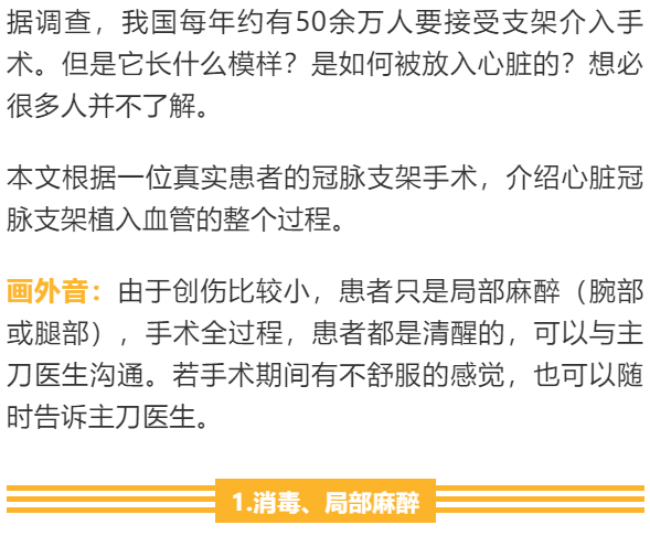 【干货】支架介入手术图文直播