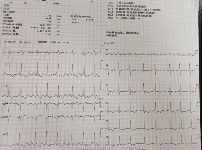 关于房颤的核心知识点，你都掌握了吗？
