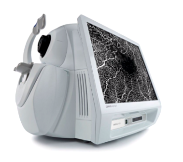 Oct什么公司一文概览眼科OCT市场概况_https://www.jmylbn.com_新闻资讯_第8张