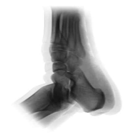 C臂怎么看解密C形臂新晋“单品王”：大视野，三维C；面向未来，一步到位！_https://www.jmylbn.com_新闻资讯_第14张