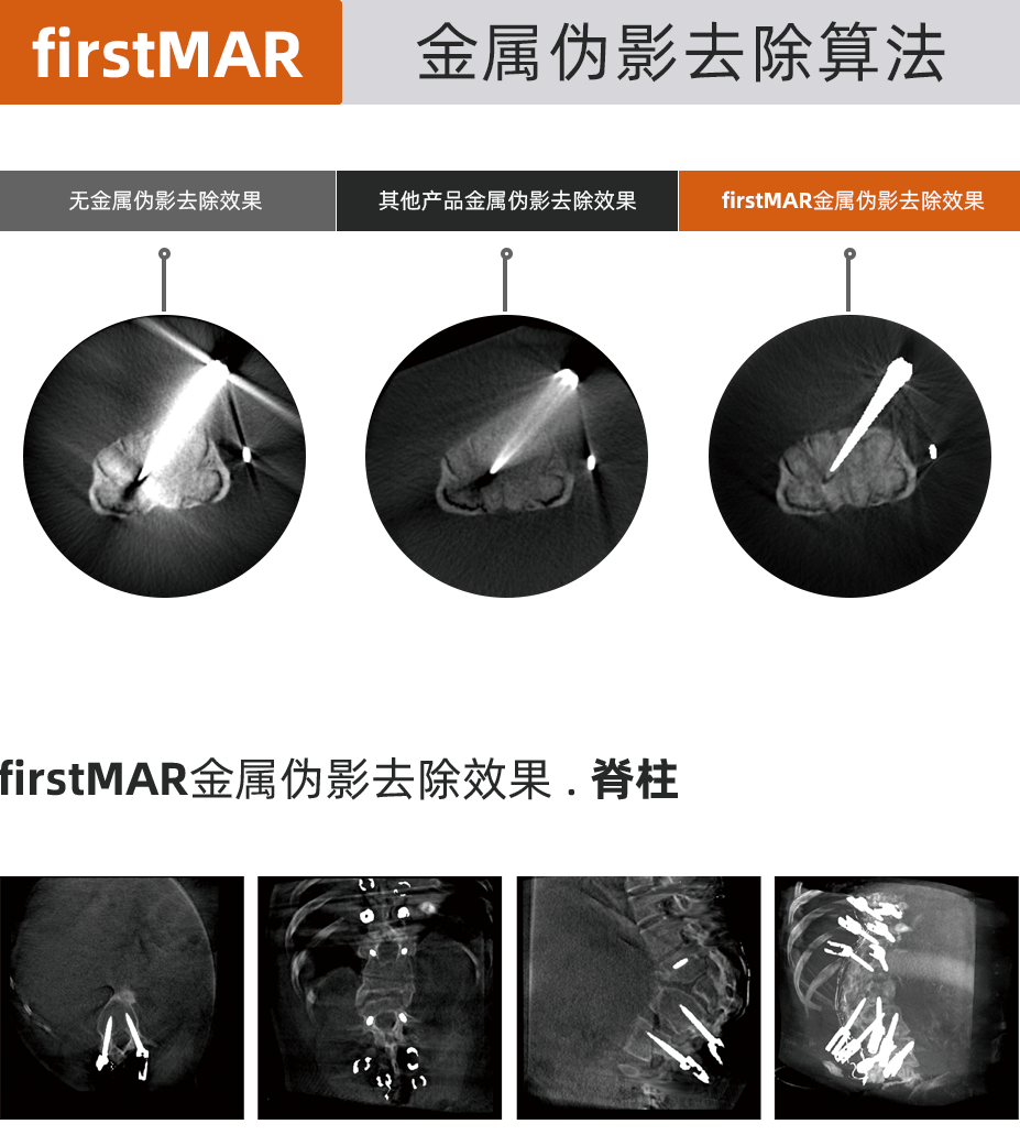 C臂怎么看解密C形臂新晋“单品王”：大视野，三维C；面向未来，一步到位！_https://www.jmylbn.com_新闻资讯_第23张