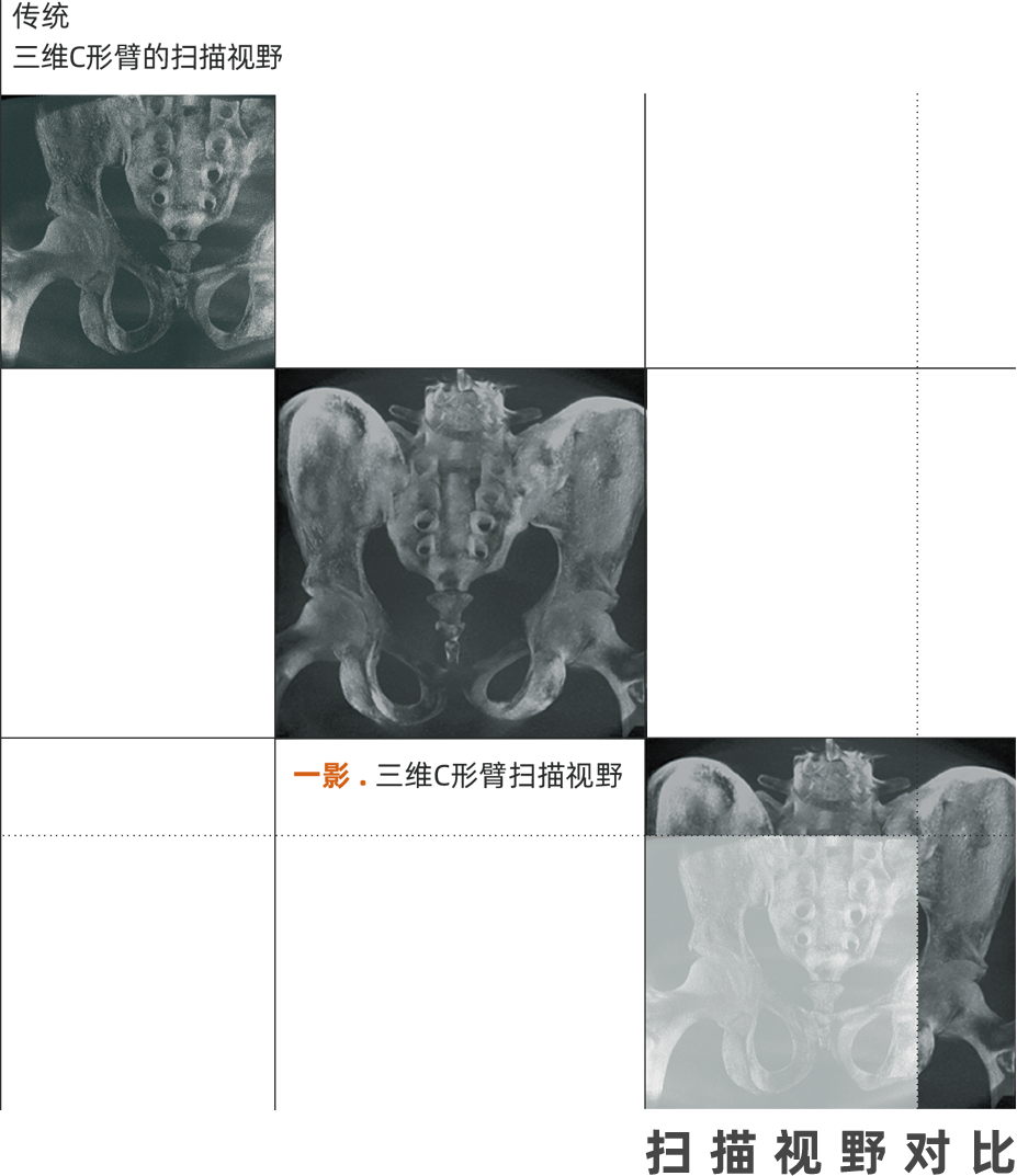 C臂怎么看解密C形臂新晋“单品王”：大视野，三维C；面向未来，一步到位！_https://www.jmylbn.com_新闻资讯_第22张