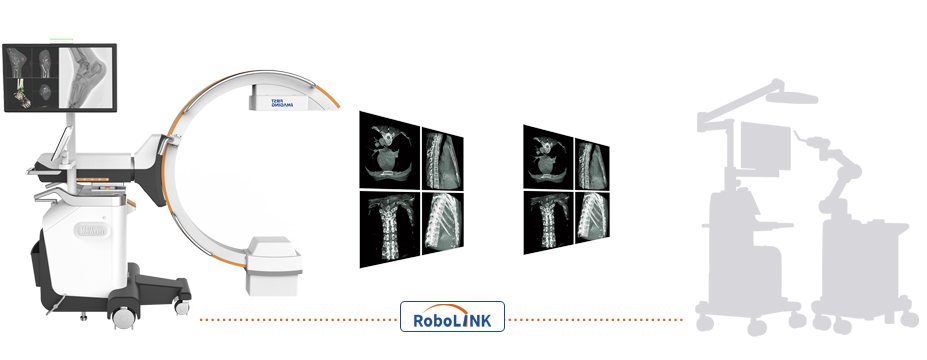 C臂怎么看解密C形臂新晋“单品王”：大视野，三维C；面向未来，一步到位！_https://www.jmylbn.com_新闻资讯_第28张
