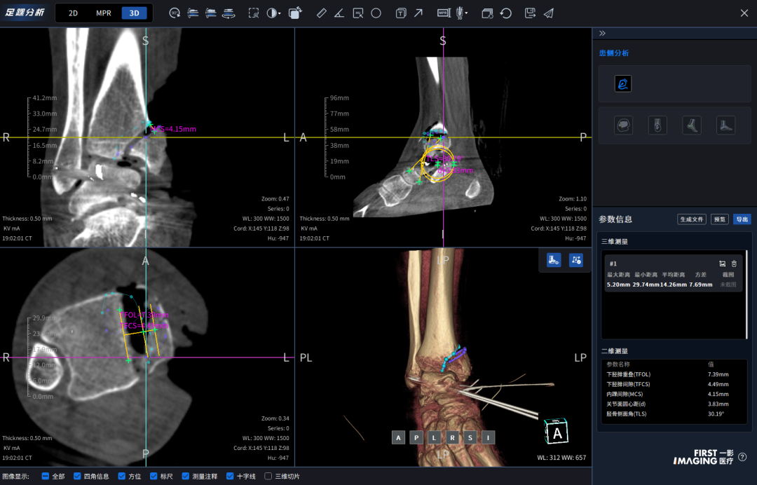 C臂怎么看解密C形臂新晋“单品王”：大视野，三维C；面向未来，一步到位！_https://www.jmylbn.com_新闻资讯_第25张