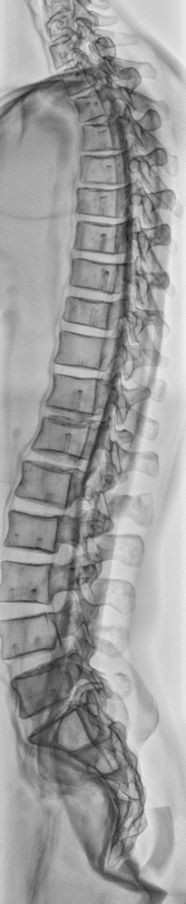 C臂怎么看解密C形臂新晋“单品王”：大视野，三维C；面向未来，一步到位！_https://www.jmylbn.com_新闻资讯_第27张