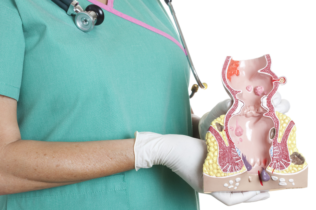 一次性肛门镜怎么检查肛肠新神器——电子肛门镜，守护你的“菊”部健康！_https://www.jmylbn.com_新闻资讯_第7张