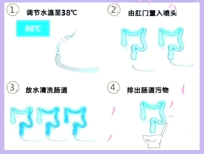 结肠水疗仪怎么操作区人民医院肠道spa新科技：无痛结肠水疗，轻松“肠”享健康_https://www.jmylbn.com_新闻资讯_第7张