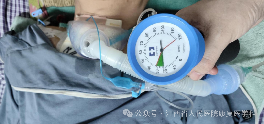 敷料芯怎么用【知识共享】气管切开患者的气道护理_https://www.jmylbn.com_新闻资讯_第3张