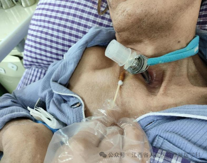 敷料芯怎么用【知识共享】气管切开患者的气道护理_https://www.jmylbn.com_新闻资讯_第7张