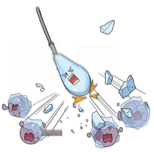 氦氩刀是什么【航医说医】“冻死”肿瘤--氩氦刀冷冻消融技术，肿瘤治疗新选择_https://www.jmylbn.com_新闻资讯_第10张