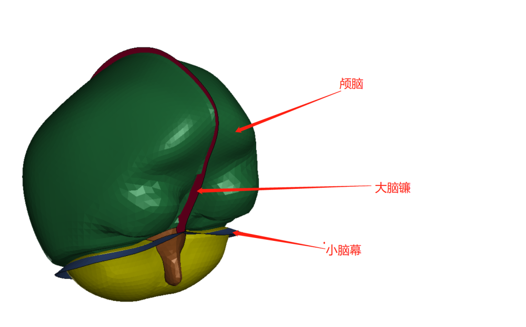 LS-DYNA | 爆炸冲击波对人体头颅作用的图2