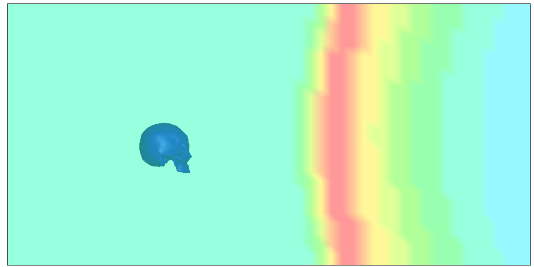 LS-DYNA | 爆炸冲击波对人体头颅作用的图3