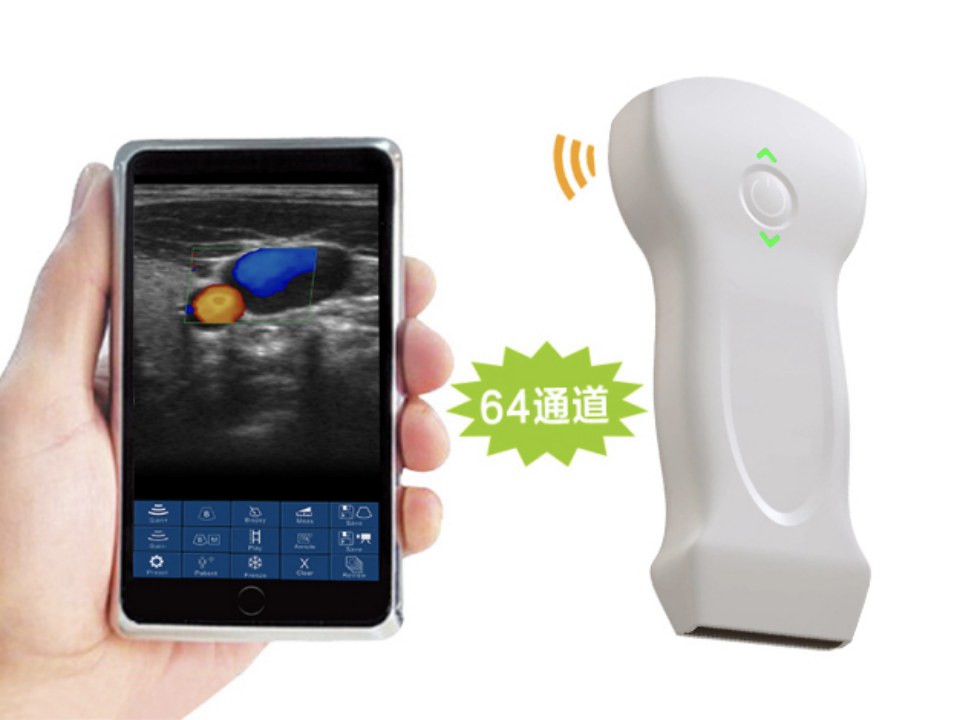 索诺星超声怎么样领跑全球的微型无线探头式掌上超声_https://www.jmylbn.com_新闻资讯_第12张