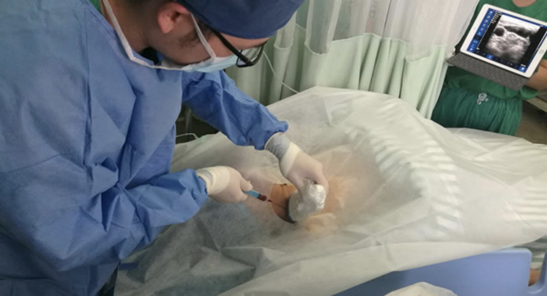 索诺星超声怎么样领跑全球的微型无线探头式掌上超声_https://www.jmylbn.com_新闻资讯_第24张