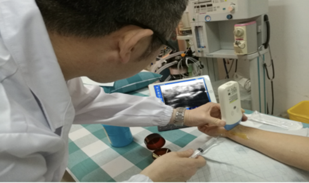 索诺星超声怎么样领跑全球的微型无线探头式掌上超声_https://www.jmylbn.com_新闻资讯_第18张