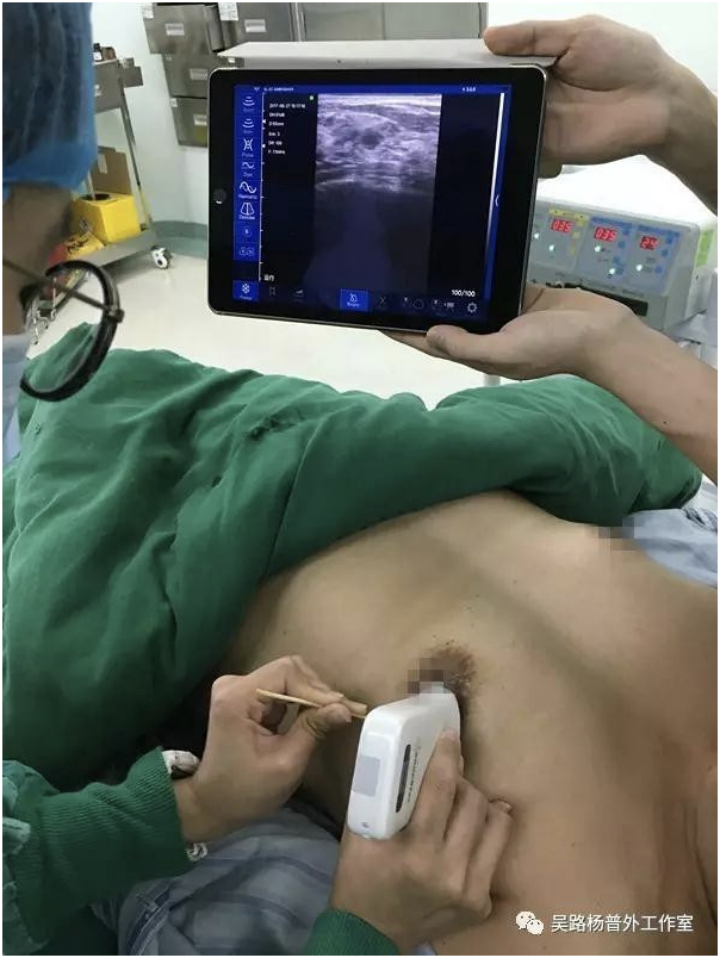 索诺星超声怎么样领跑全球的微型无线探头式掌上超声_https://www.jmylbn.com_新闻资讯_第16张