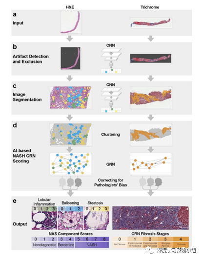 基于AI的组织学评分可以对NASH临床试验中的入组标准和终点进行自动化和可重复的评估