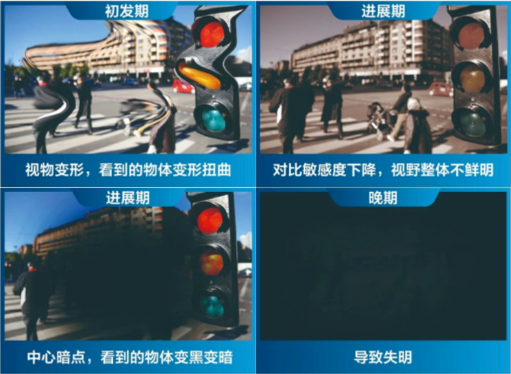 相机afc是什么意思【科普】我们的眼睛就是我们最好的“相机”，要好好珍惜_https://www.jmylbn.com_新闻资讯_第6张