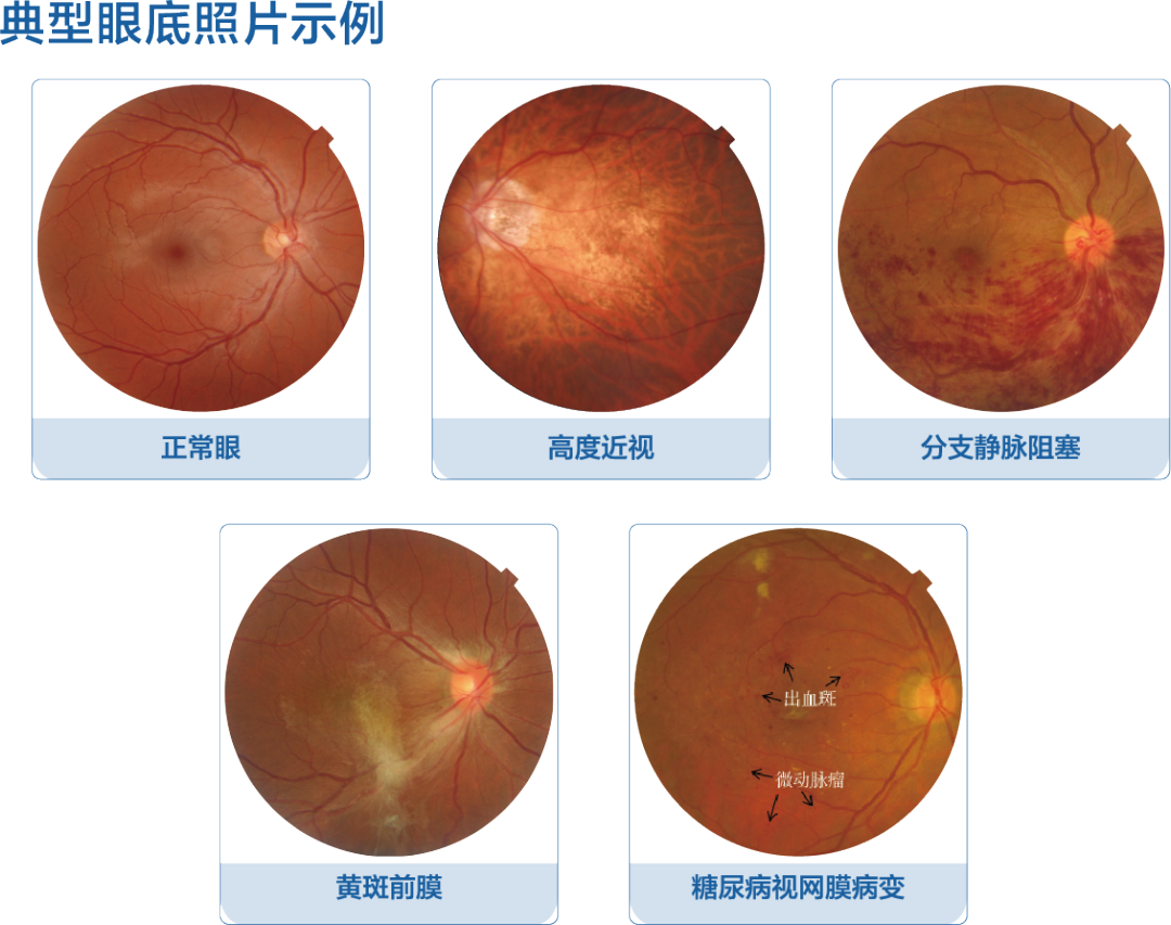 相机afc是什么意思【科普】我们的眼睛就是我们最好的“相机”，要好好珍惜_https://www.jmylbn.com_新闻资讯_第3张