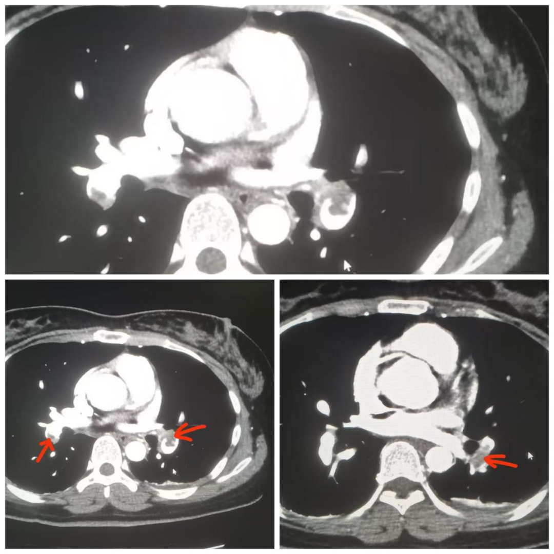 esaote彩超怎么用久站久坐族，请警惕下肢深静脉血栓_https://www.jmylbn.com_新闻资讯_第5张