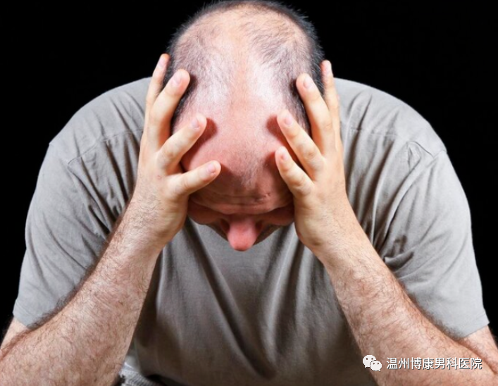 男性脱发的三大原因
