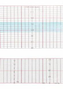 监护仪怎么打印招标公告丨天津市滨海新区塘沽妇产医院心电图纸及胎儿监护仪打印纸项目二次招标公告_https://www.jmylbn.com_新闻资讯_第6张