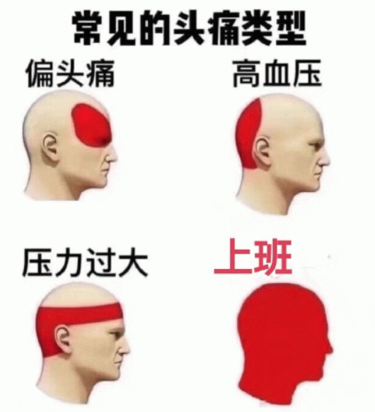 动态脑电图怎么看动态脑电图：大脑的“24小时监测员”_https://www.jmylbn.com_新闻资讯_第3张