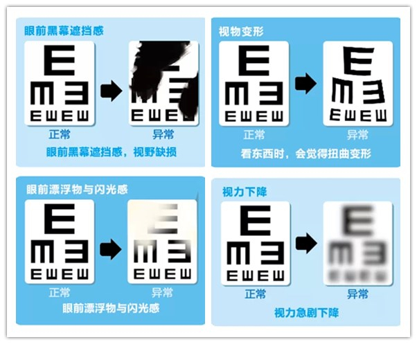 意大利眼科怎么样从意大利飞到杭州，眼睛突然看不见了……_https://www.jmylbn.com_新闻资讯_第11张