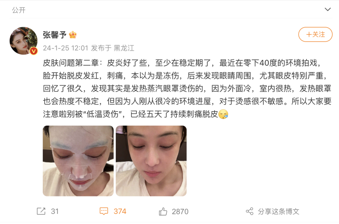 医用眼罩是什么这个火爆网络的“护眼神器”到底能不能戴？该怎么戴？-上海聚慕医疗器械有限公司